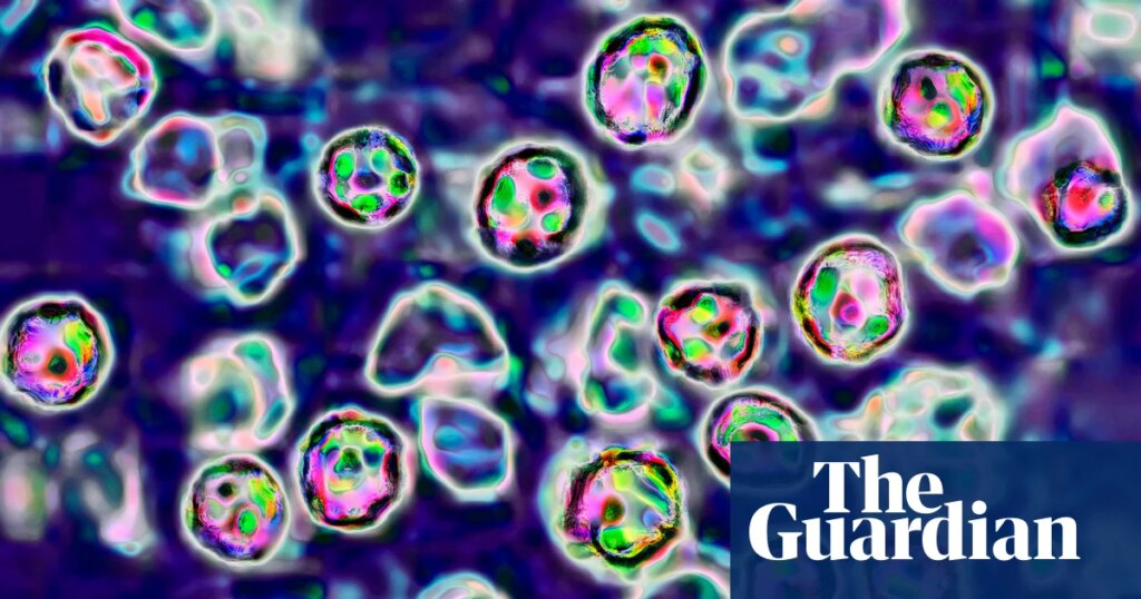 Two unvaccinated people die of measles in Pennsylvania | Pennsylvania