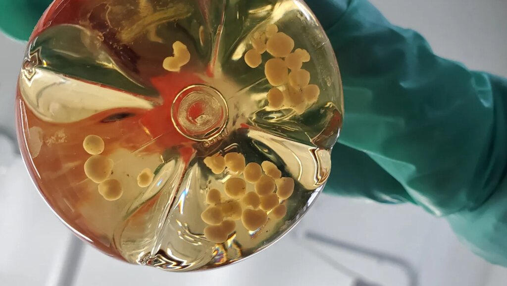 These mice have human (nerve cells) on the brain