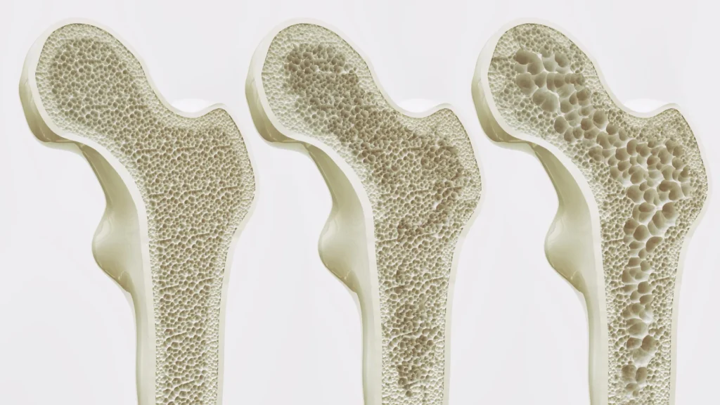 Too much coffee may weaken bones, study finds