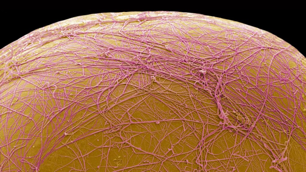 An experimental drug kills fat cells, rather than shrinking them