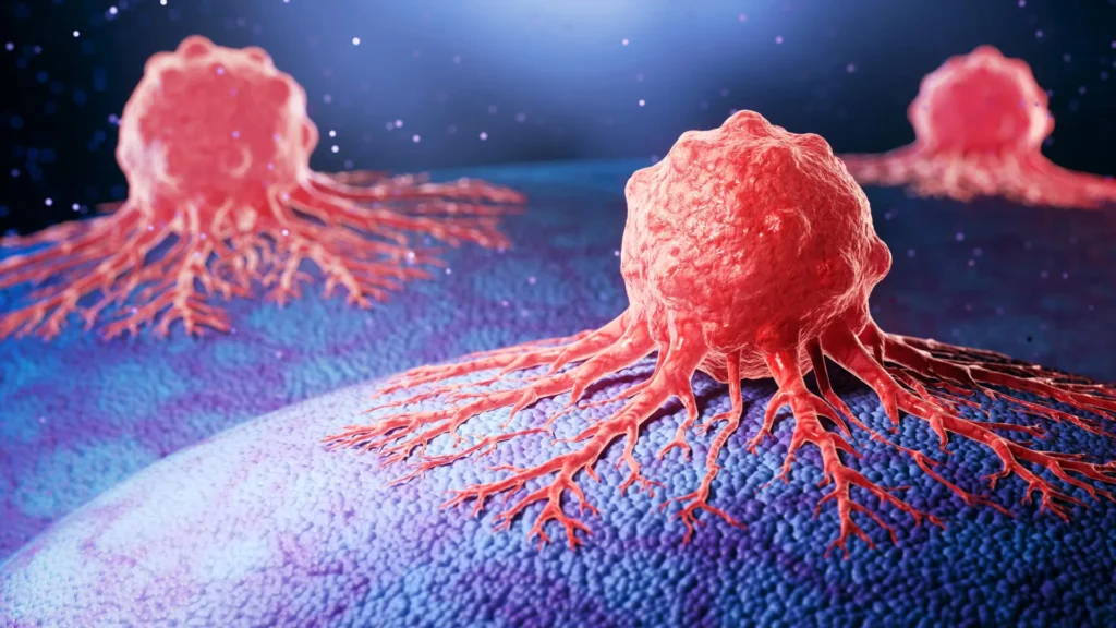 Cancer is rising in younger adults, and scientists can’t fully explain why